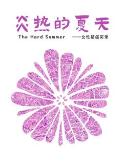 免费在线观看《炎热的夏天》